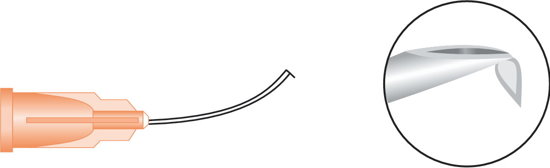 Endocapsular Cystotome Formed (Joyce)